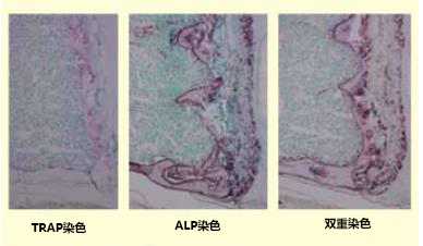 石蜡切片骨相关酶（TRAP，ALP）双重染色