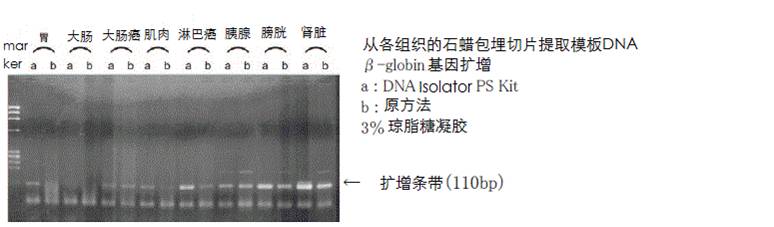 石蜡包埋组织DNA提取试剂盒