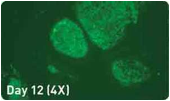 microRNA增强试剂盒                  microRNA Booster Kit