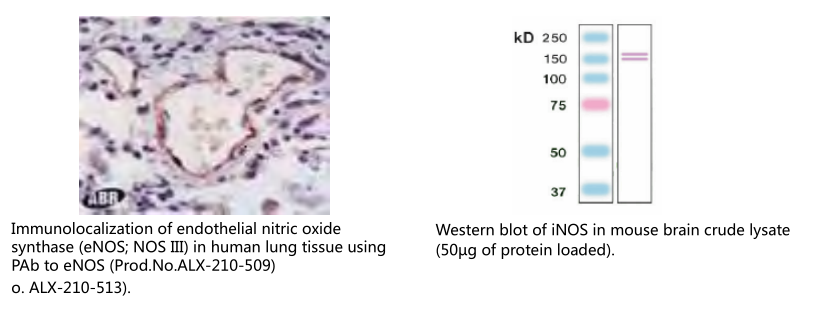 乳腺癌抗药性蛋白单克隆抗体 (BXP-53)                  Breast cancer resistance protein, mAb (BXP-53)