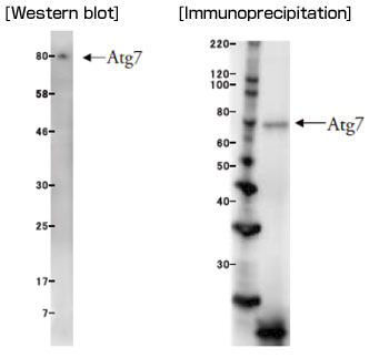 抗Atg7单克隆抗体（克隆号：ATG7-2）                  Anti Atg7 (Clone: ATG7-2) Monoclonal antibody