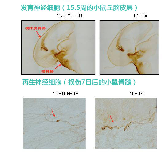 神经生长相关蛋白GAP43单克隆抗体