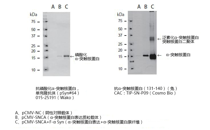 α-突触核蛋白聚集检测试剂盒                  (ALPHA)-Synuclein Aggregation Assay Kit