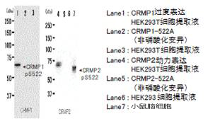 抗磷酸化CRMP1/2（Ser522），兔                  Anti Phosphorylated CRMP1/2 (Ser522),   Rabbit