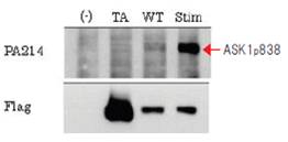 抗磷酸化ASK1，单克隆抗体                  Anti Phosphorylated ASK1, Monoclonal   Antibody