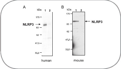 NLRP3抗体                  anti-NLRP3/NALP3, mAb