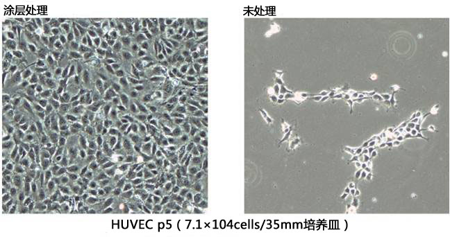 cellnest人Ⅰ型重组胶原蛋白肽                  cellnest, recombinant peptide based on human collagen type
