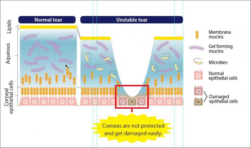 泪液粘蛋白检测试剂盒                  Tear Mucin Assay kit