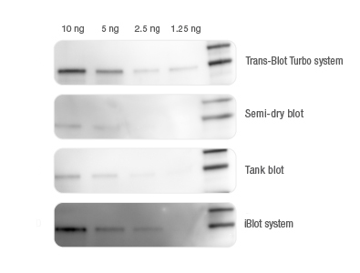 Bio-rad Trans-Blot Turbo全能型蛋白转印系统170-4150-基因扩增仪