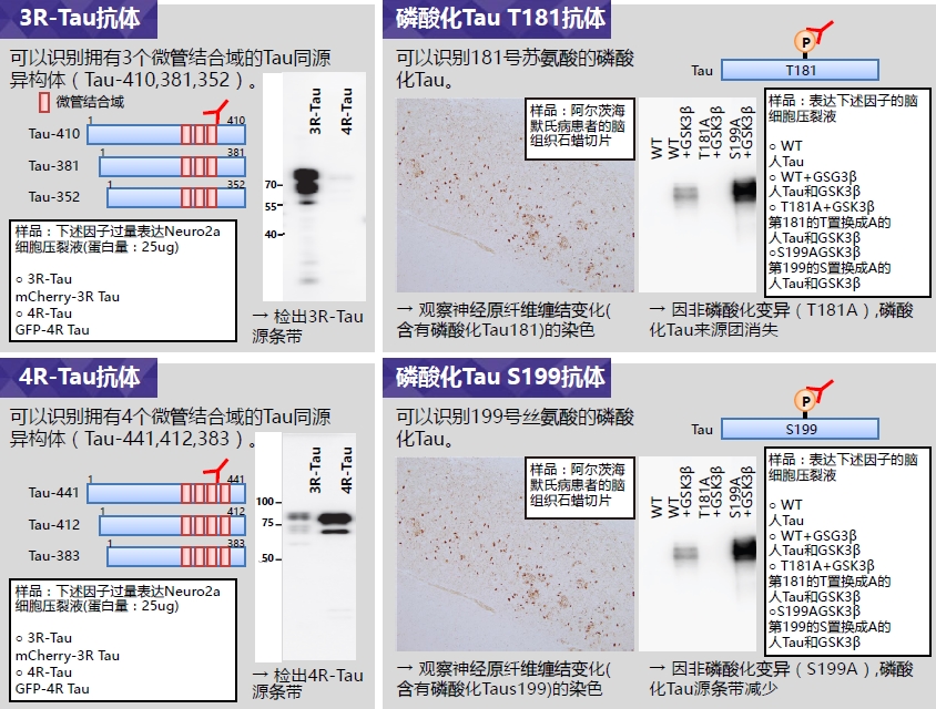 抗3R-Tau，大鼠单克隆抗体（2A1-1F4） Anti 3R-Tau, Rat Monoclonal Antibody(2A1-1F4)-价格-厂家-供应商-wko富士胶片和光