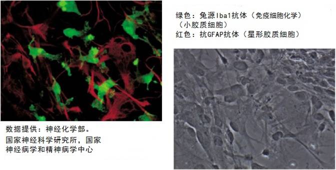 Anti Iba1, Rabbit (for Immunocytochemistry)-价格-厂家-供应商-wko富士胶片和光