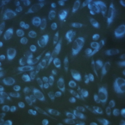 CytoSeeing（Reversible Cytoplasm Blue）                              可清洗去除的细胞染色探针