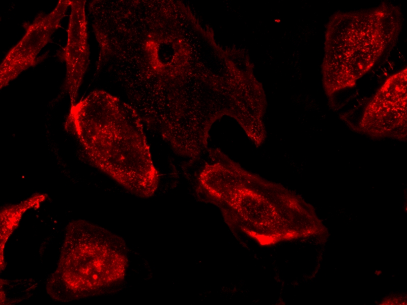 iFluor 647-刀豆蛋白A(ConA)缀合物    货号25595-AAT Bioquest荧光染料