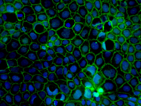 Human Stem Cell Derived Intestinal Epithelial Cells